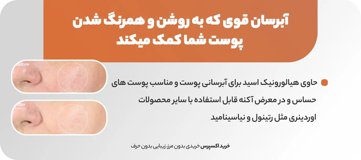 خرید سرم آلفا آربوتین اوردینری